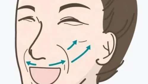 拉皮 拉皮