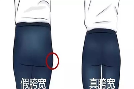 是翘臀还是假胯宽