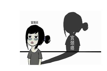 子宫癌是什么原因引起的 女性子宫癌早晚期症状是什么