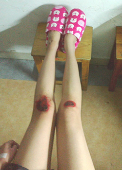 美女膝盖内涵图  妹子你的腿肿么了美女膝盖红了