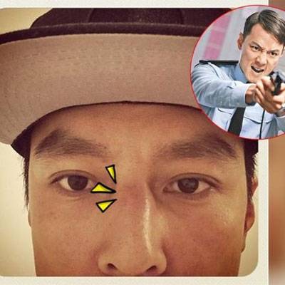 太敬业！吴彦祖鼻梁被打断直接直接掰回来