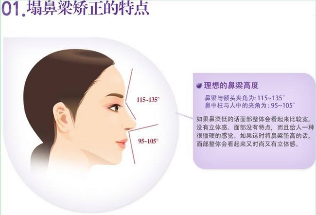 怎么让鼻梁变高