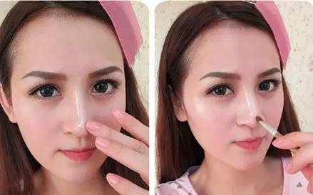 怎么让鼻梁变高