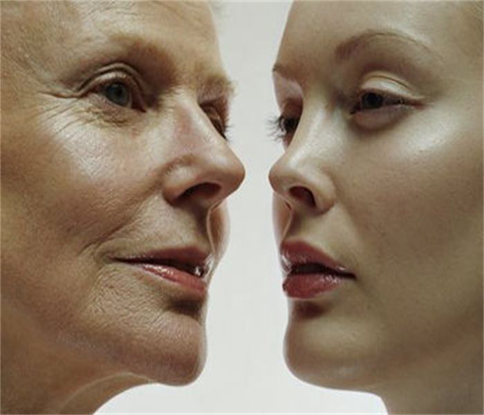 脸部皱纹怎么去除才能看不到岁月的痕迹