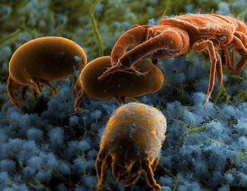 如何去除螨虫这个强烈的过敏源