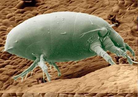 如何去除螨虫这个强烈的过敏源