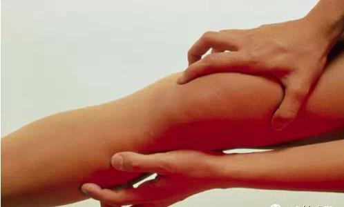 关节炎怎么治疗