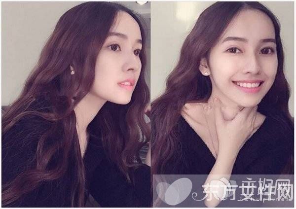 2017超流行蛋卷头 7款韩式蓬松蛋卷发型推荐