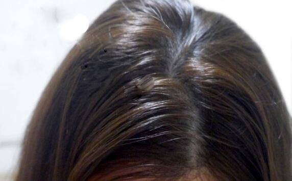 头发油怎么办 油性头发的护发方法TOP8