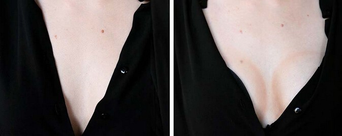 这样也可以 不用动刀塑造丰满胸部效果