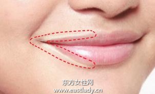 不易脱妆的局部遮瑕之矫正唇周与嘴角的色素沉淀