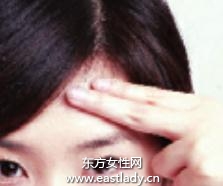 粉刺、痘痘肌肤的化妆技巧