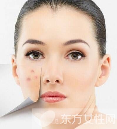 如何清除粉刺 粉刺和痘痘又有什么区别