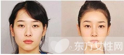 如何瘦脸最快最有效 这么做瞬变小v脸