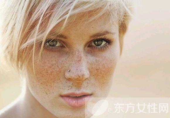 雀斑是怎么形成的 不花钱的雀斑去除方法推荐