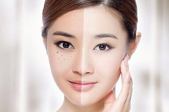 激光祛斑的危害有多大 如何做好术后护理