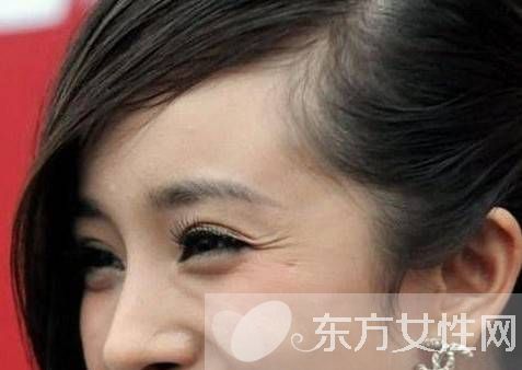 简单按摩手法轻松去鱼尾纹