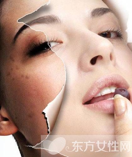 激光祛斑好不好 怎样祛斑最有效