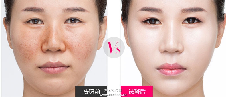 快速消除老年斑 老年斑的食疗方法大全