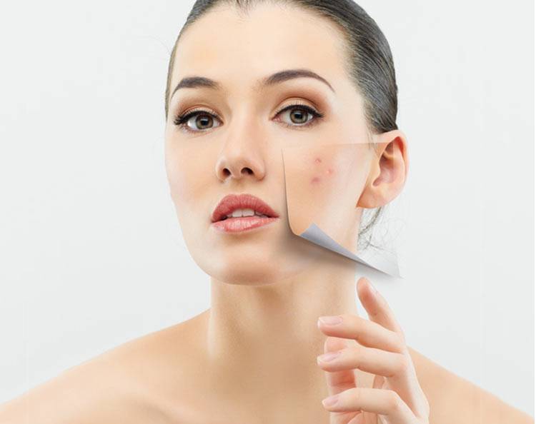 激光祛痘有好有坏 揭密你所不知的副作用