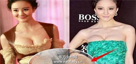 隆胸没啥了不起 但这些女星隆胸后还死不承认