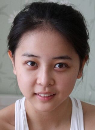 黄褐斑能去掉吗 孕期有效预防黄褐斑的方法