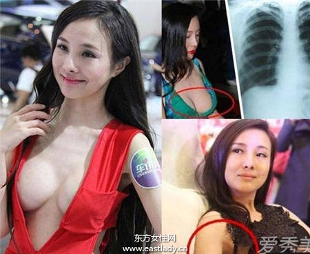 隆胸没啥了不起 但这些女星隆胸后还死不承认