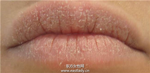 嘴唇干燥脱皮暗沉怎么办 试试这个方法让你嘴唇变的超粉嫩