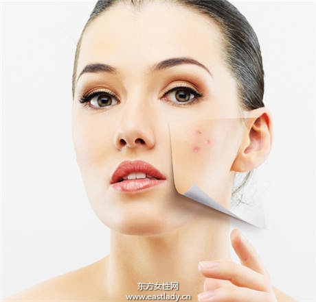 别误会 痘痘肌最容易搞混的误区