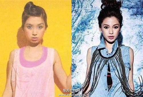 Angelababy 小S也做牙齿矫正 成功瘦小臉