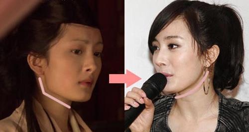 杨幂是否整容 杨幂整容前后照片 杨幂整容后图片