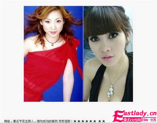 美女主播柳岩整容前后对比照片