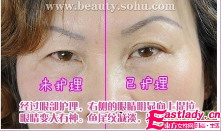 60老太按摩去皱纹 效果惊人