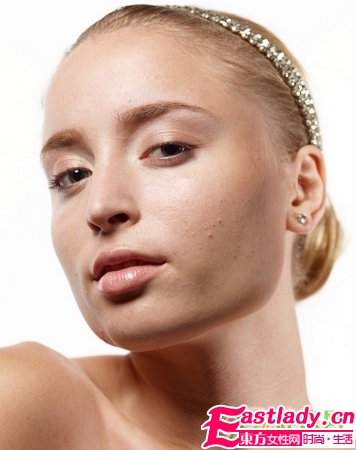 脸上各部位长痘原因