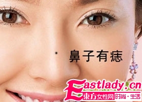不能留在脸上的9颗痣