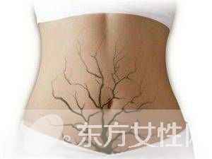 慢性便秘怎么办 常吃这些让你远离它