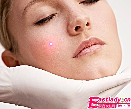 10个预防痘痘的生活常识