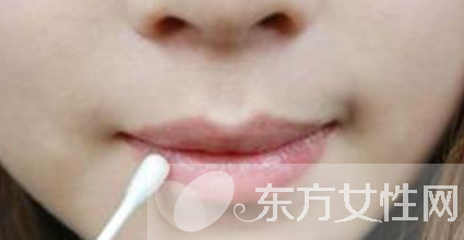 嘴上起泡是什么原因 该怎么治疗