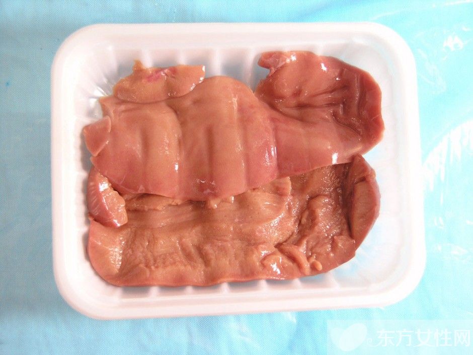 高血脂治疗与饮食 这些食物吃了会严重影响病情哦