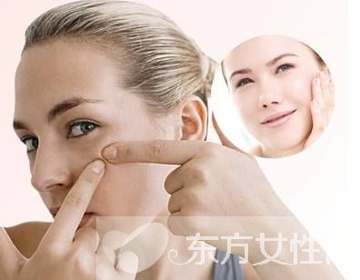 青春痘的治疗小偏方 7个偏方帮你解决面子问题