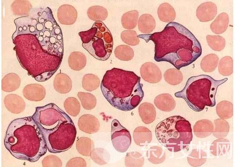 白细胞偏低的原因 白细胞低吃什么好