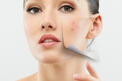 女性内分泌失调症状有哪些 是什么原因造成的呢