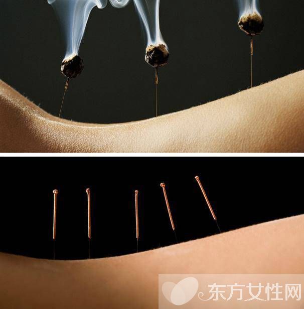 治疗黄疸的最好办法 这种方法治疗黄疸效果非常棒哦