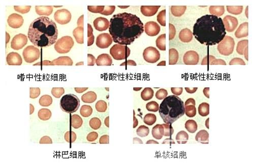 白细胞偏低的原因 白细胞低吃什么好