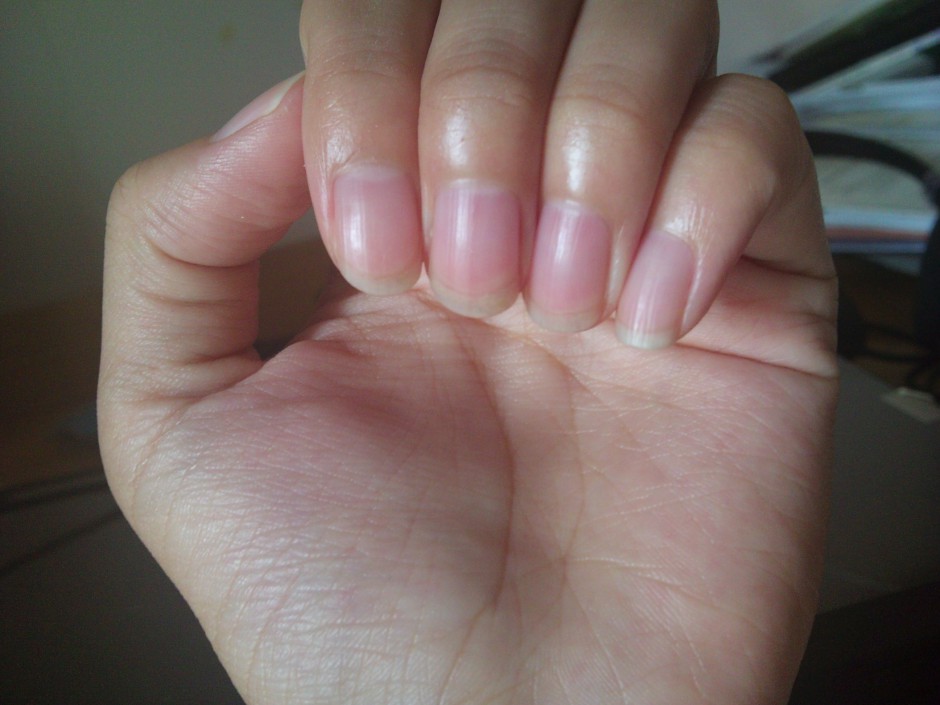 指甲上有竖纹是怎么回事 5个妙招教你如何调理