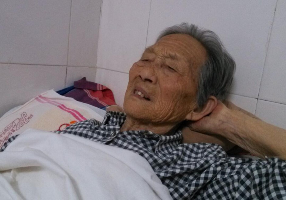 小脑萎缩的诱因及症状 小脑萎缩吃什么好