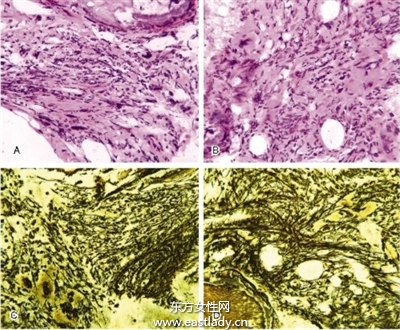 神经官能症能治愈吗 神经官能症治疗方法