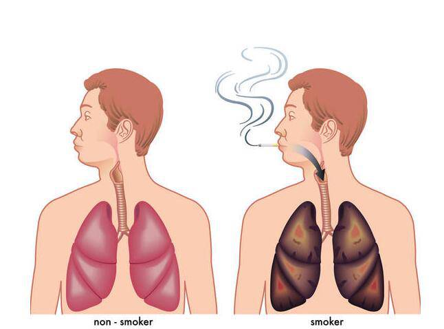 怎样戒烟最有效 细数吸烟的十大危害