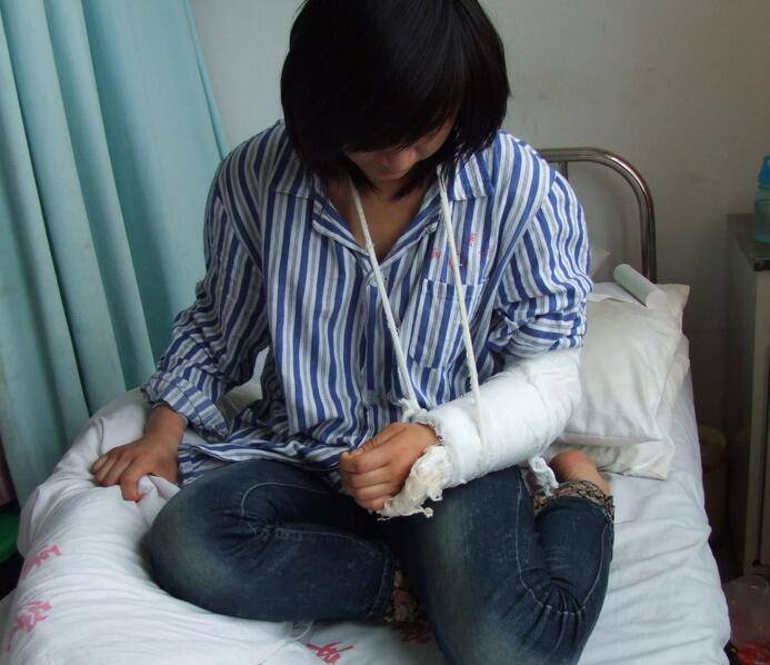 骨折愈合时间需要多久 愈合康复训练