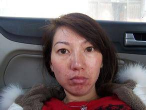 怎么调节内分泌失调 内分泌失调有什么症状